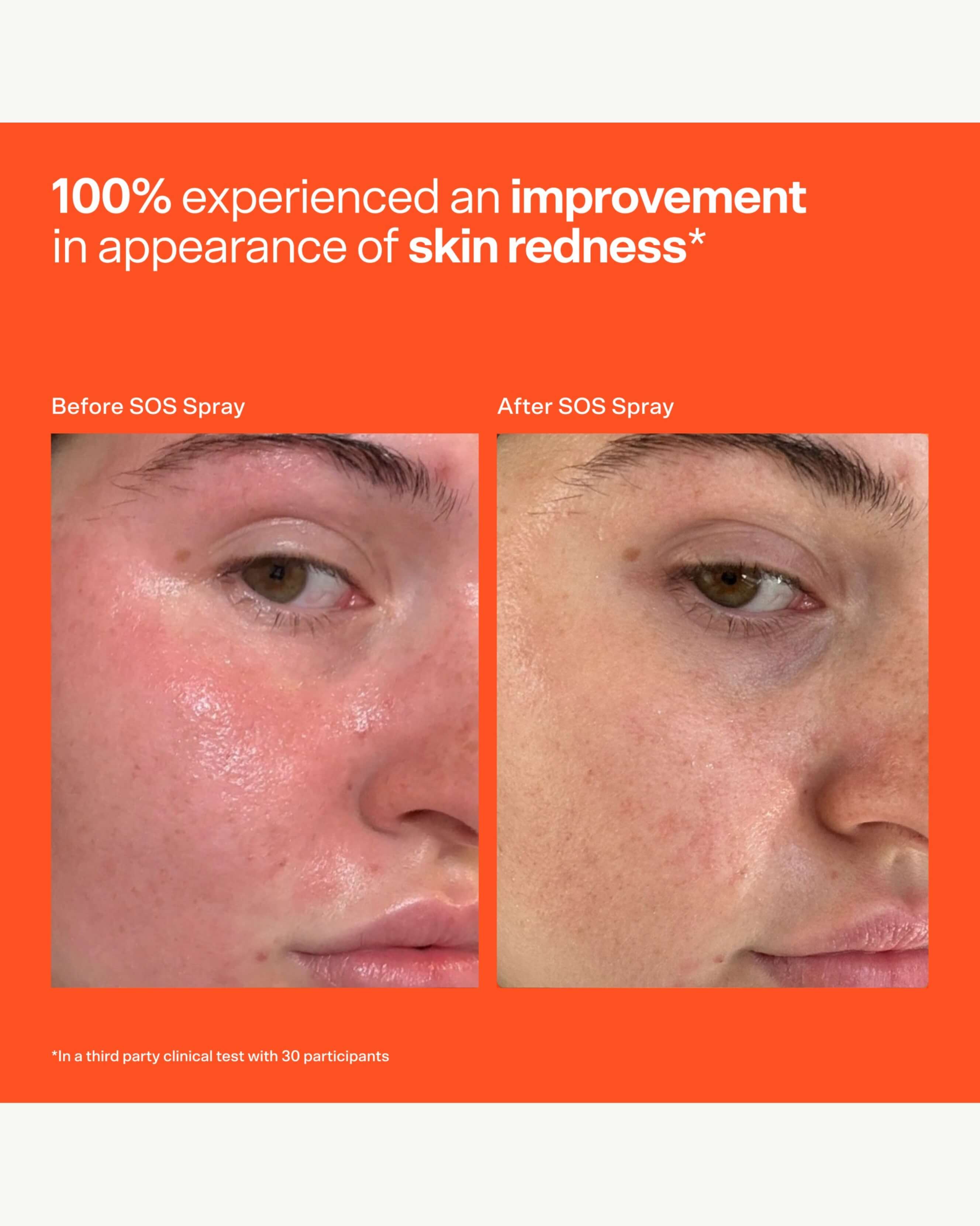 SOS Stressed Skin Starter Set