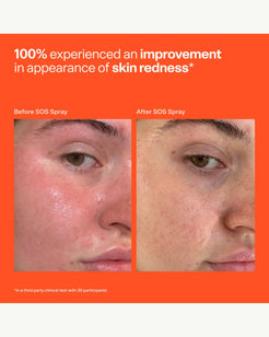 SOS Stressed Skin Starter Set