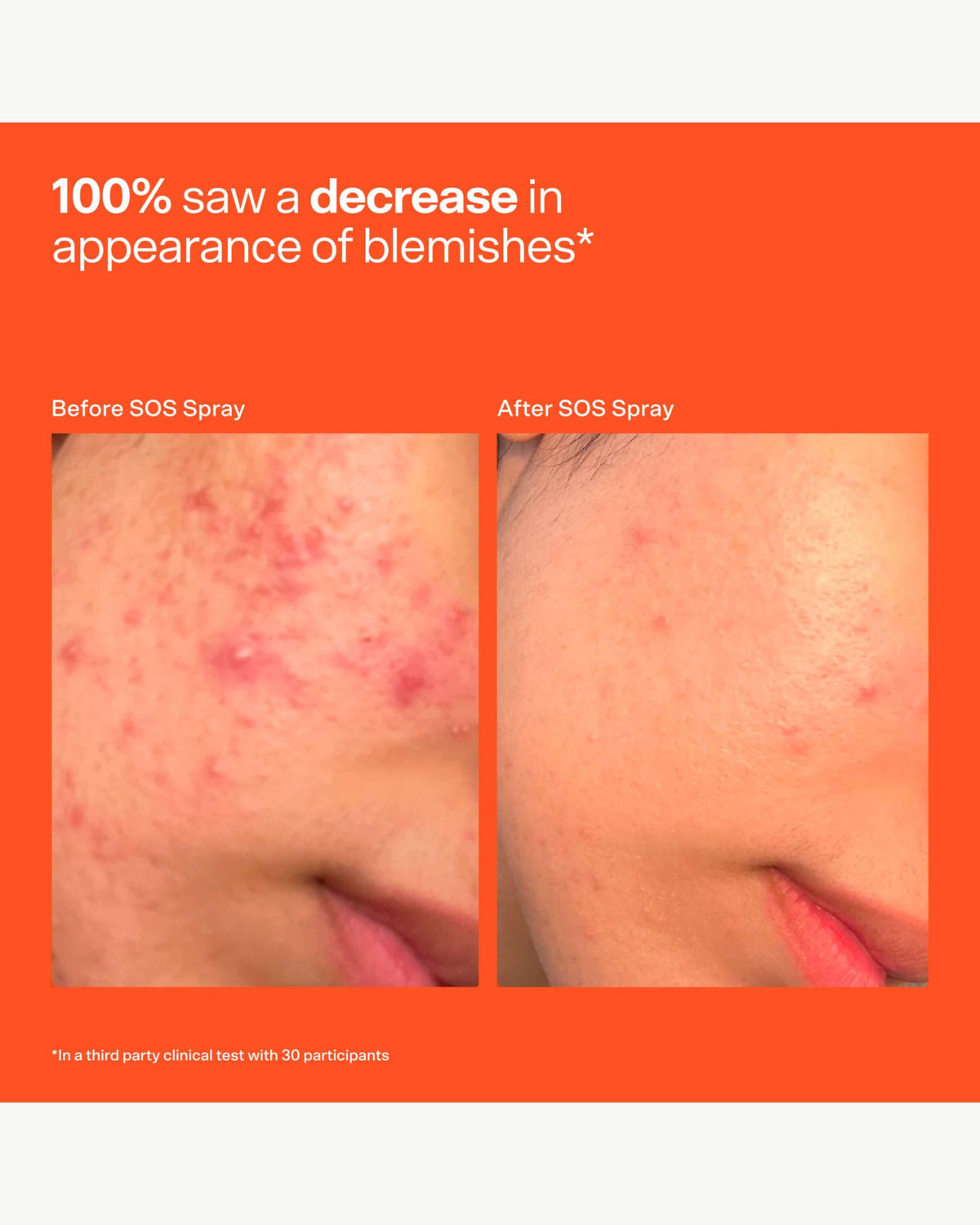 SOS Stressed Skin Starter Set