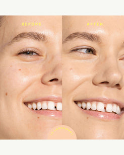 10 Larchmont (light with yellow undertones)