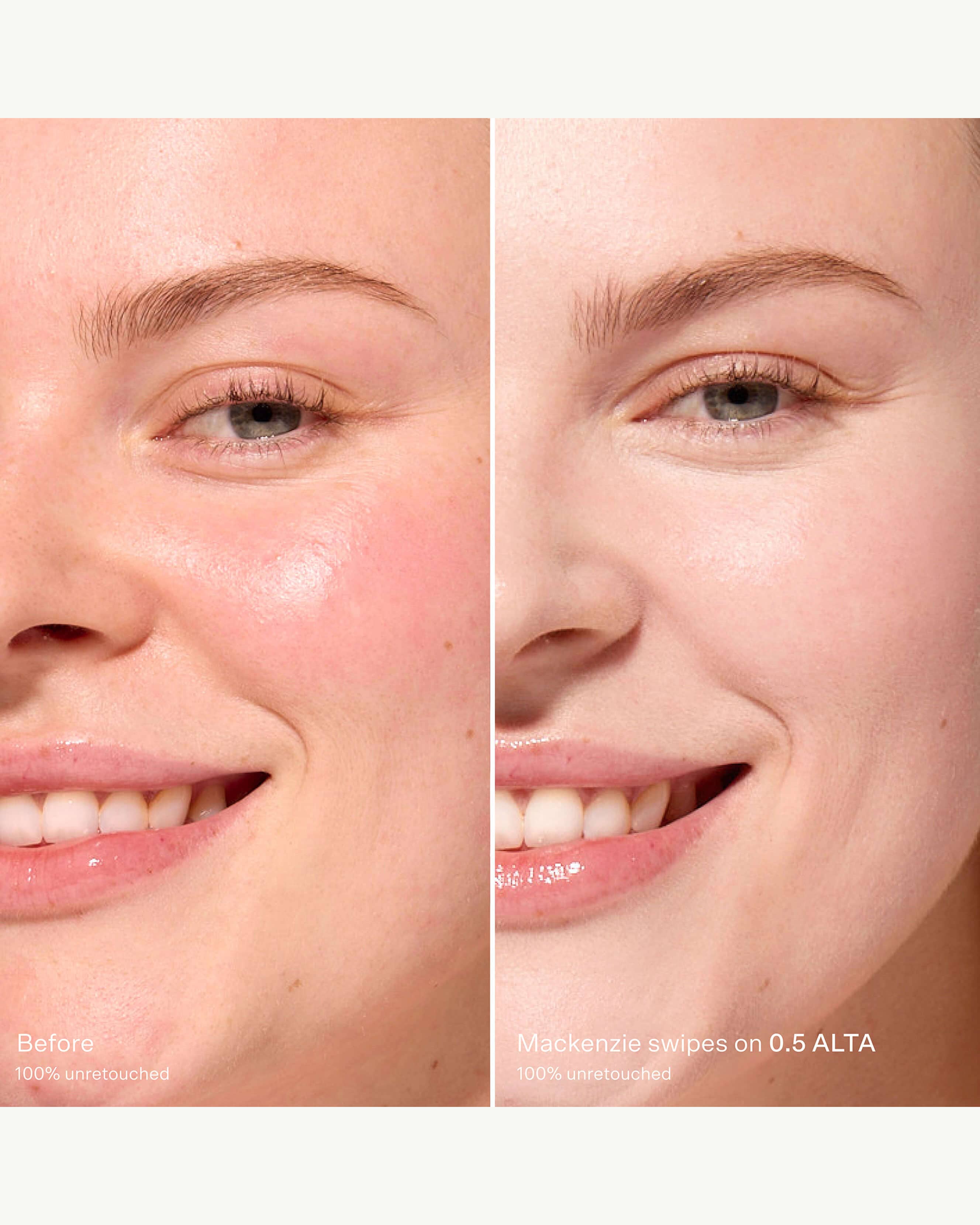 0.5 ALTA (Fair with pink undertones)