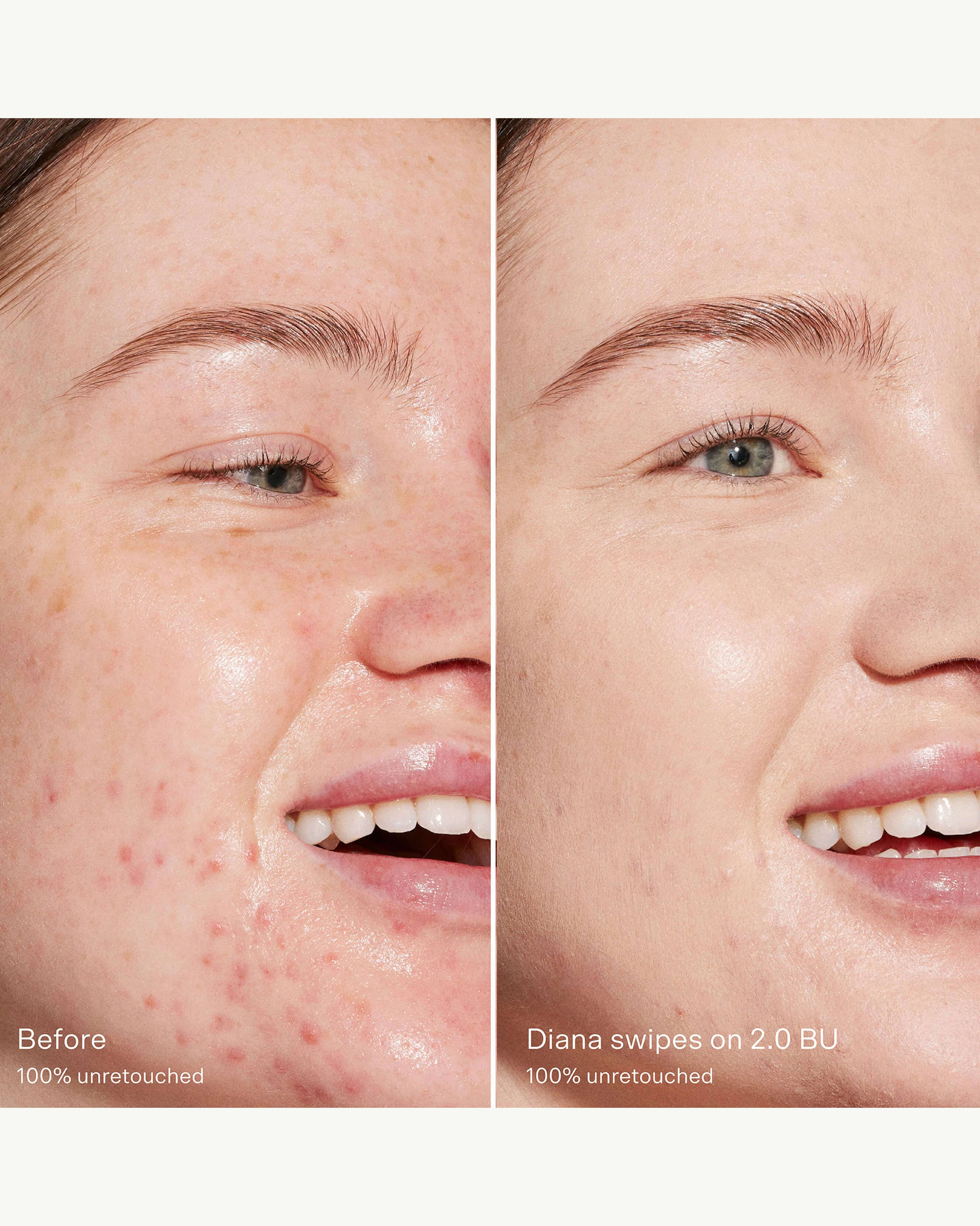 2.0 BU (light with neutral cool undertones)