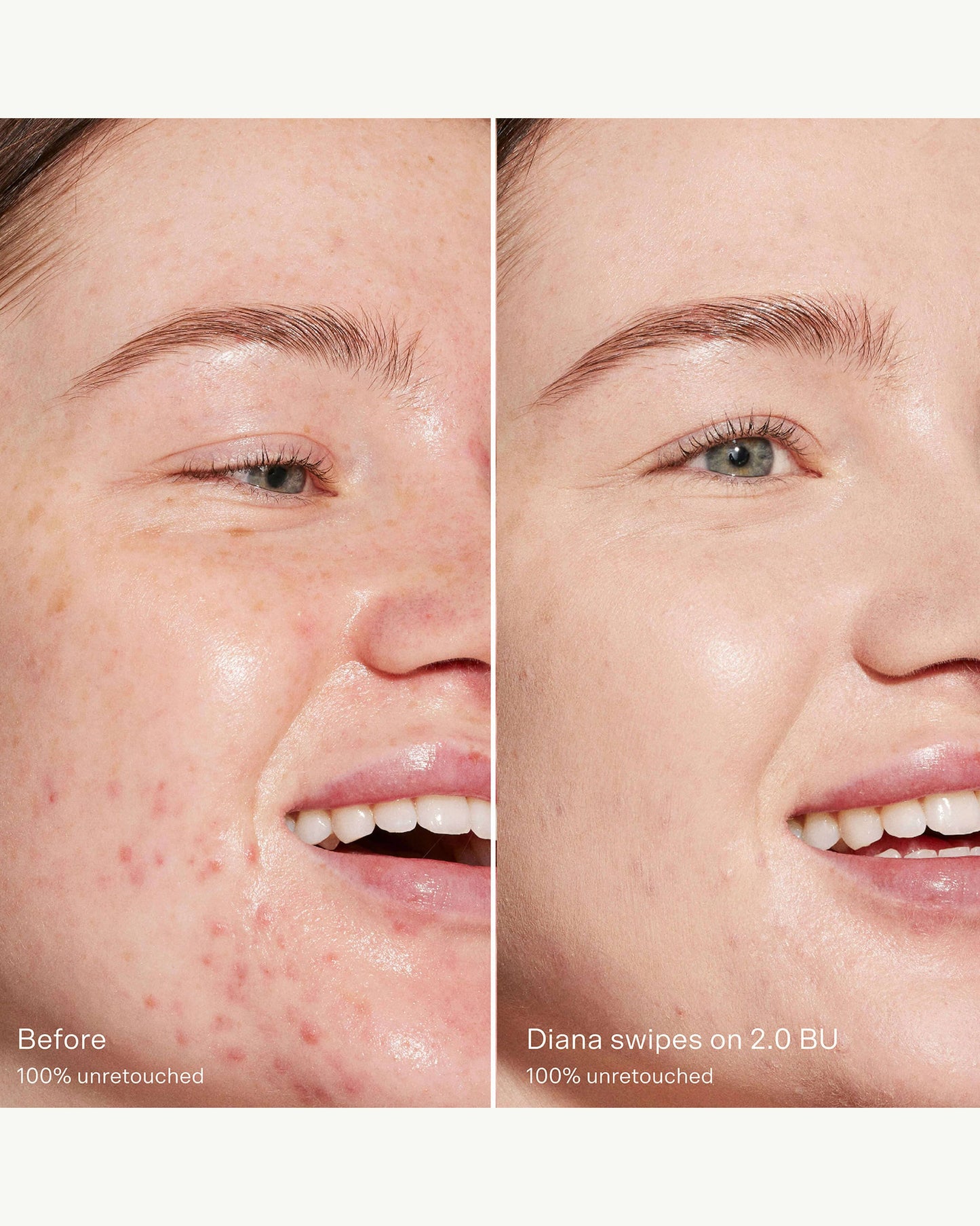 2.0 BU (light with neutral cool undertones)