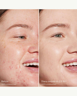 2.0 BU (light with neutral cool undertones)