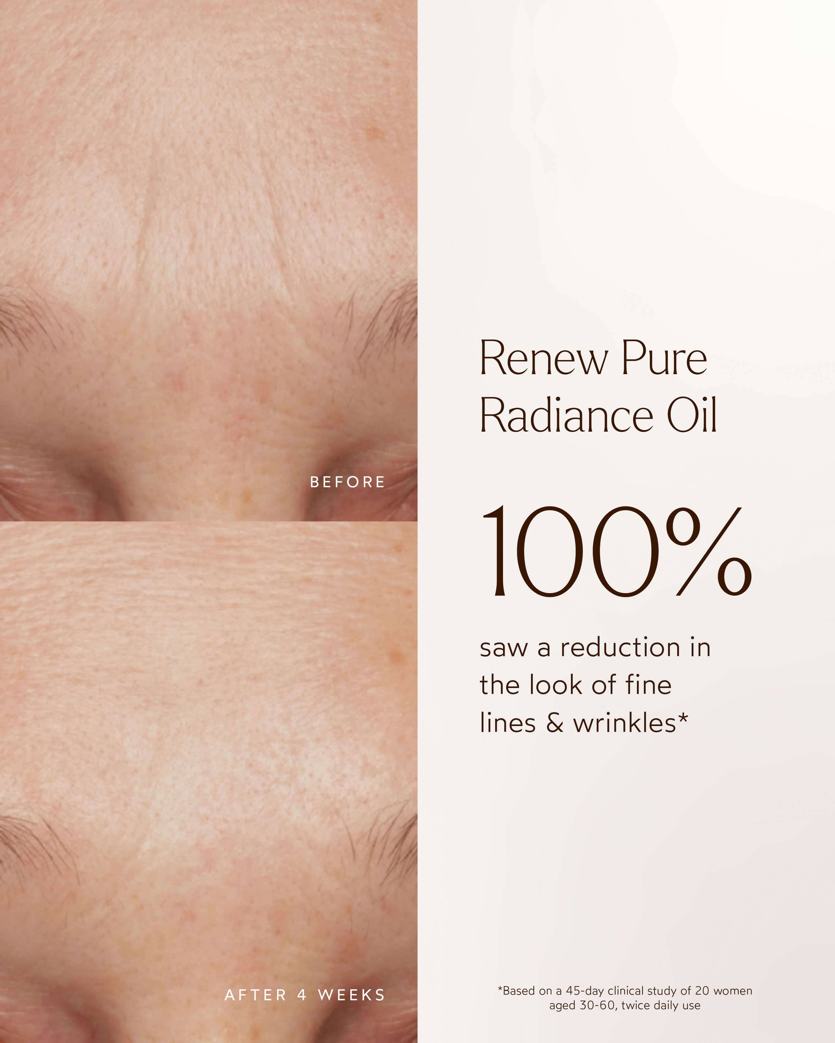 A True Transformation