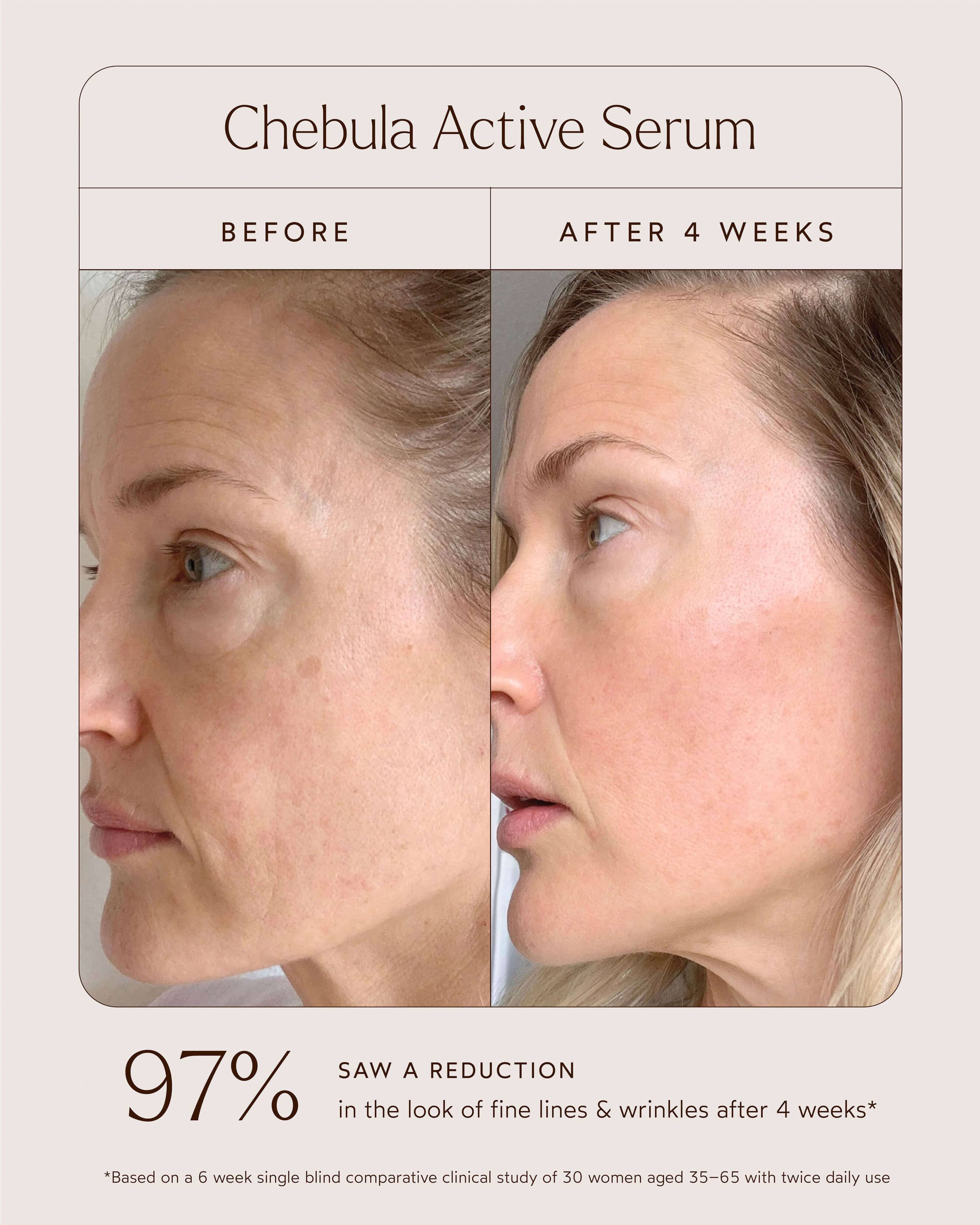 A True Transformation