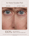 At-Home Facialist Peel