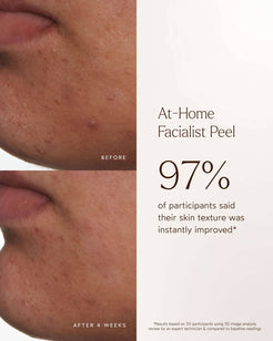 At-Home Facialist Peel