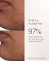 At-Home Facialist Peel