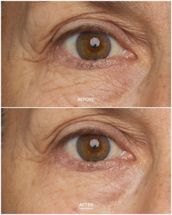 Chebula Multi-Corrective Eye Patches