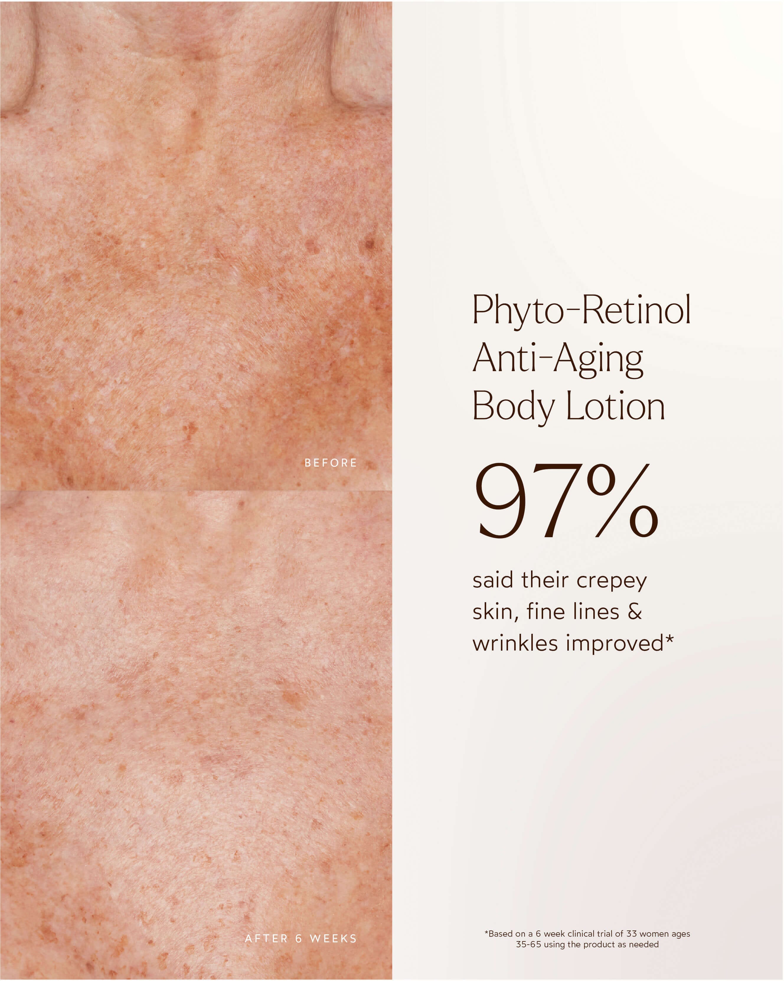 Phyto-Retinol Anti-Aging Body Lotion