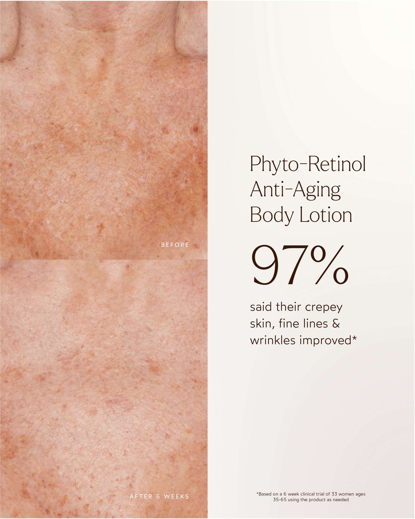Phyto-Retinol Anti-Aging Body Lotion