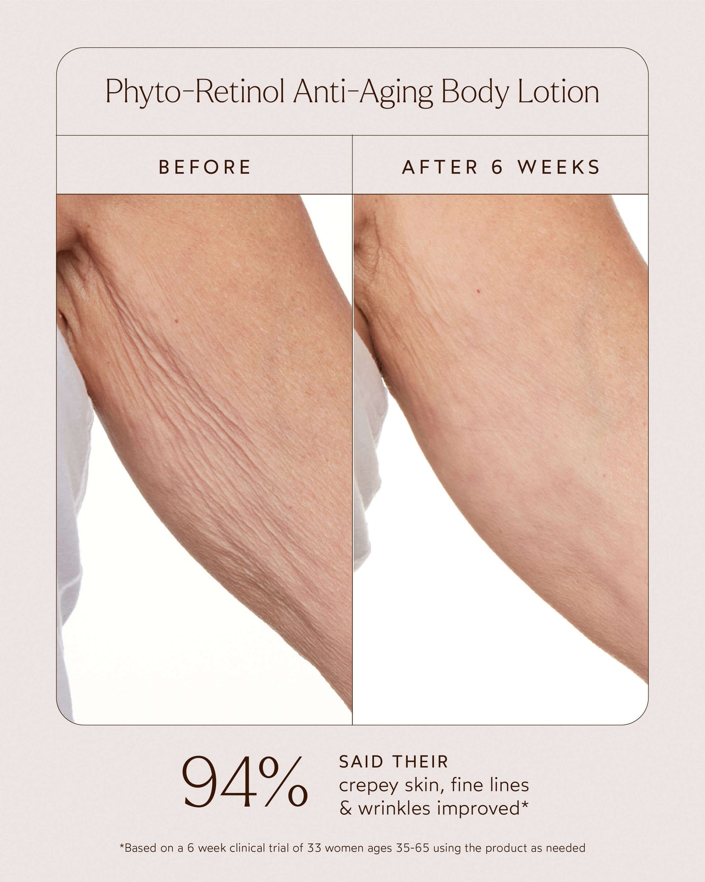 Phyto-Retinol Anti-Aging Body Lotion