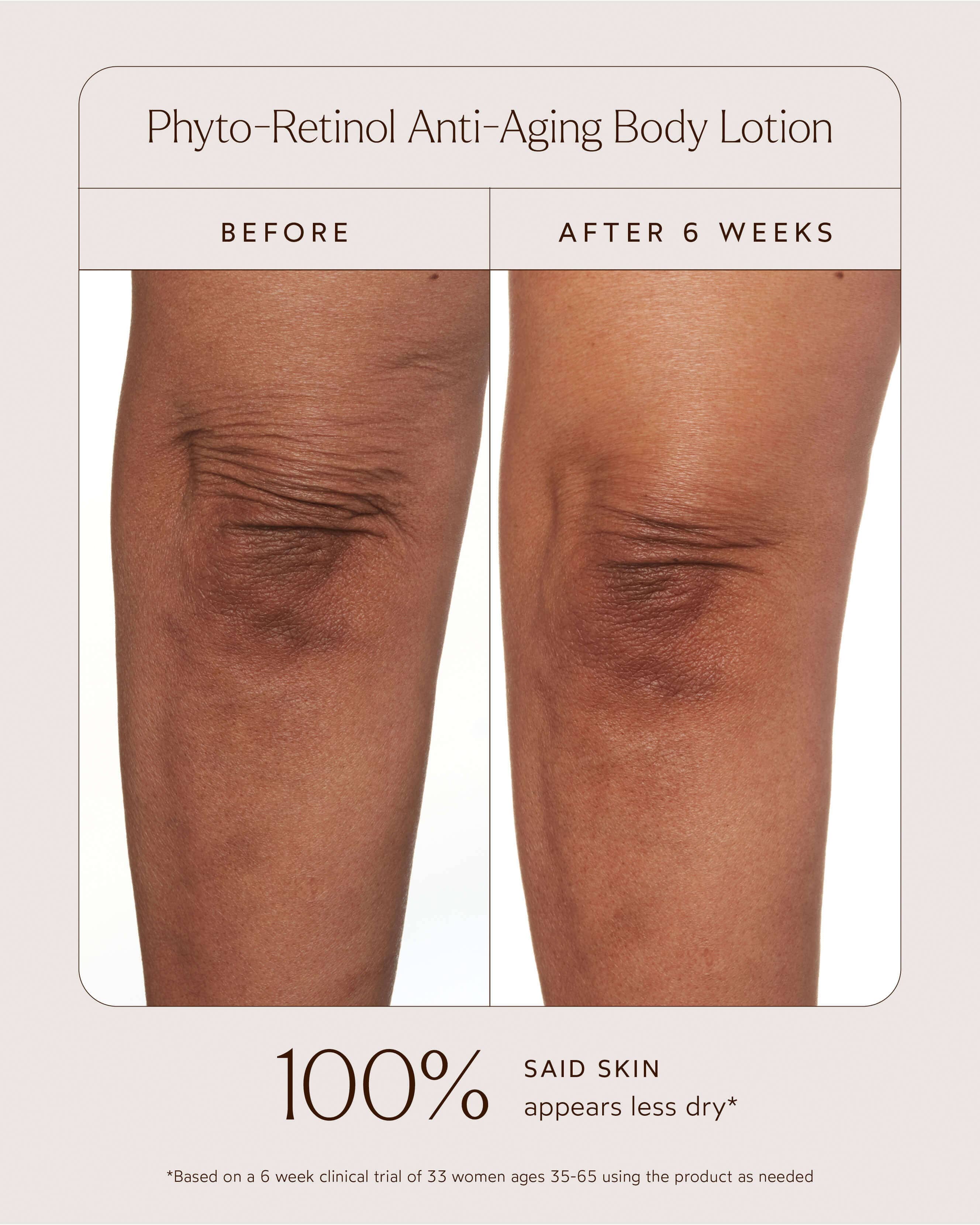 Phyto-Retinol Anti-Aging Body Lotion