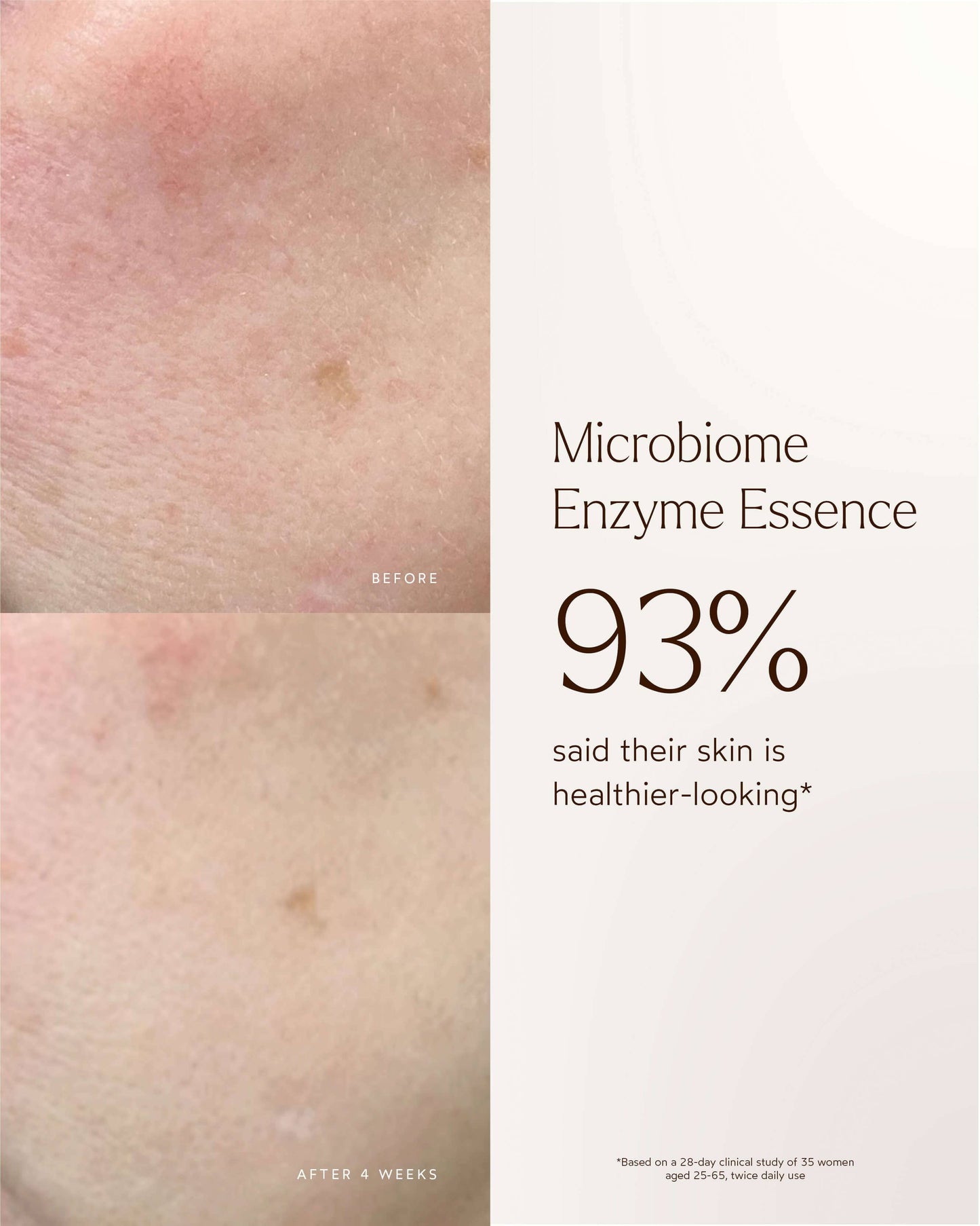 Renew Microbiome Enzyme Essence