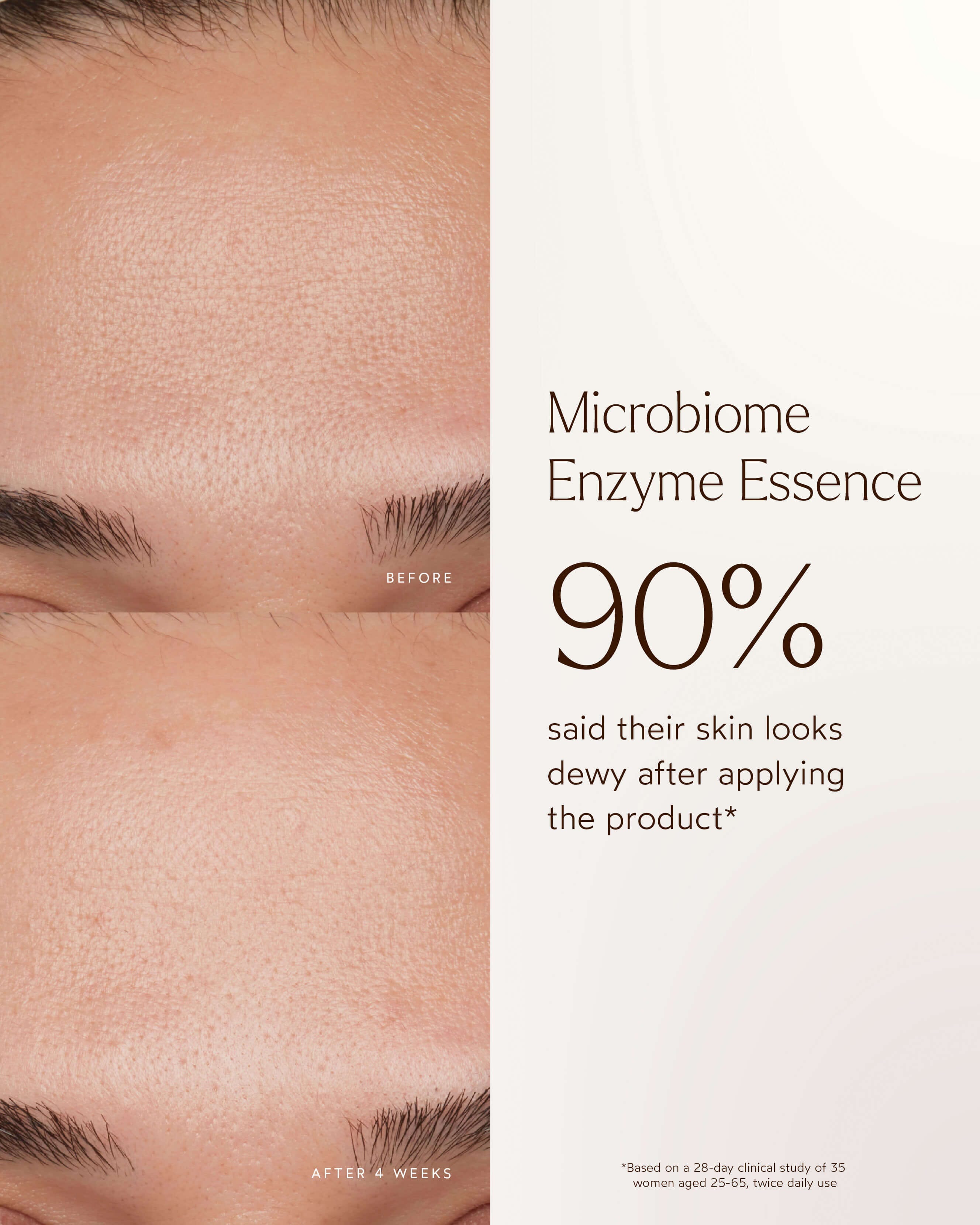 Renew Microbiome Enzyme Essence