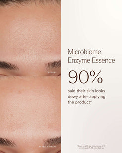 Renew Microbiome Enzyme Essence