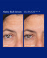 Alpine Rich Cream Barrier Moisturizer for Dry & Sensitive Skin