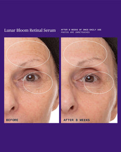 Lunar Bloom Retinol Serum for Fine Lines, Wrinkles & Uneven Skin Tone