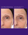 Lunar Bloom Retinol Serum for Fine Lines, Wrinkles & Uneven Skin Tone