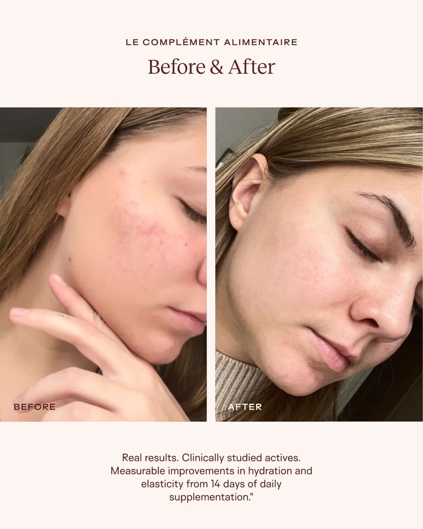 Le Complément Alimentaire – Ceramide-Rich Skin Supplement