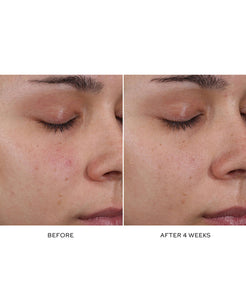 Pore Refining Complex