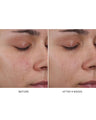 Pore Refining Complex