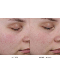 Pore Refining Complex