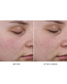 Pore Refining Complex