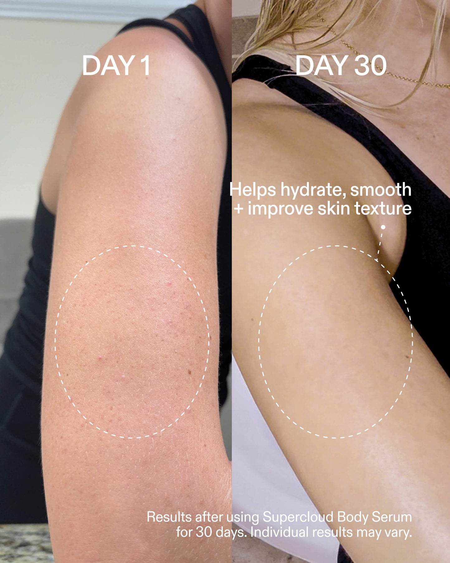 Supercloud Body Serum+