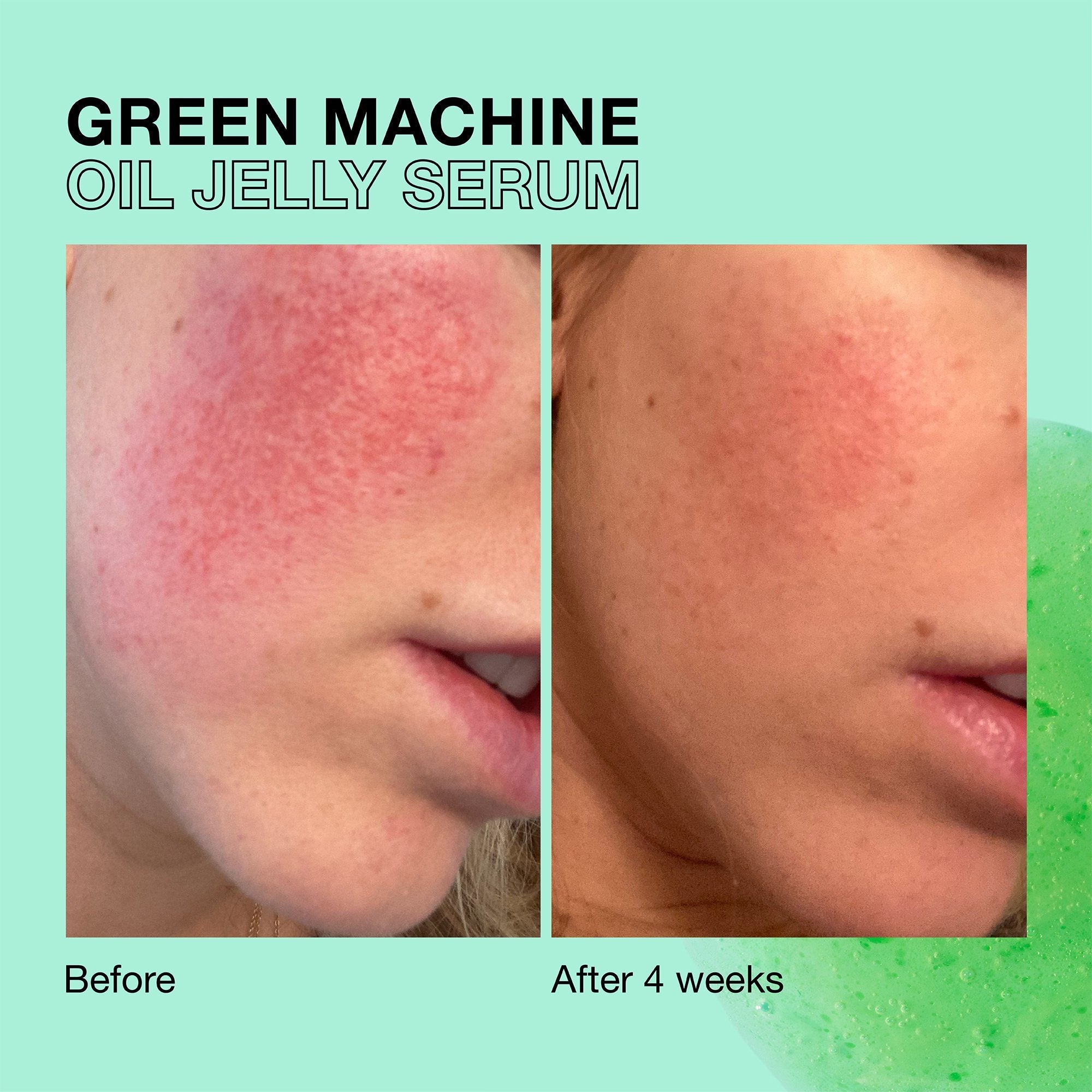 Green Machine Vitamin C Dark Spot & Hyperpigmentation Serum - iNNBEAUTY  PROJECT